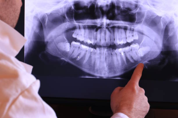 Best Broken or Cracked Tooth Emergency Dentist in Wadsworth, IL